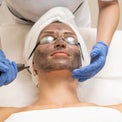 Get Clear Skin Fast: Spectra Laser Carbon Peel in Dubai