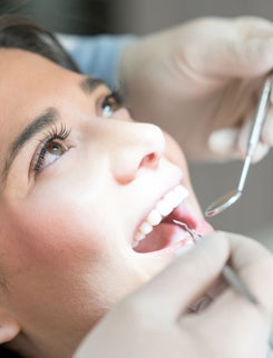 Implant Dentar București - Ghid Complet pentru Sănătatea Zâmbetului Tău