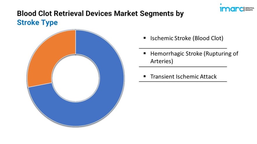 Blood Clot Retrieval Devices Market